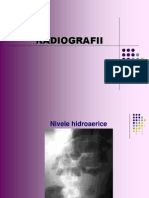 Radiografii digestiv