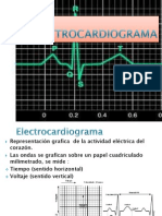 Electrocardiogram A