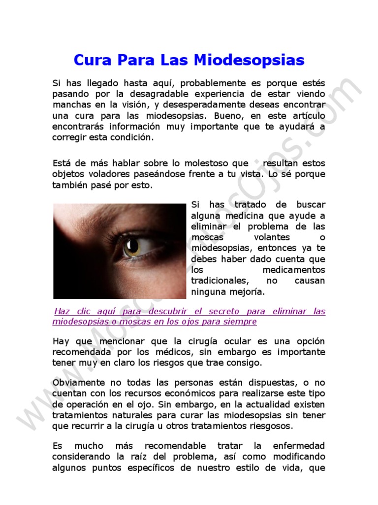 Cura para Las Miodesopsias en El Ojo: Como Curar Las Miodesopsias o ...