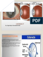 Cataract Lecture