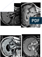 Imagenes Neuro