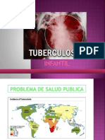 Tuberculosis Infantil[1]