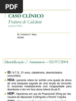 Caso Clínico Fratura de Calcâneo