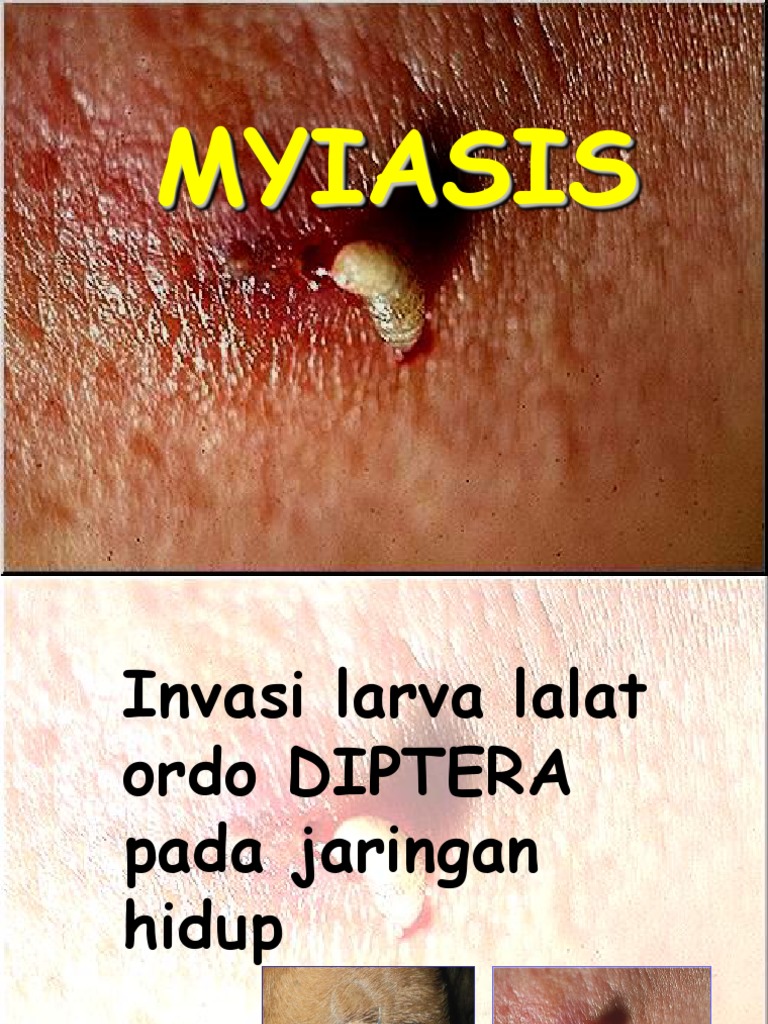 MYIASIS (Recovered) | PDF | Sains & Matematika