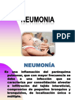 NEUMONIA Pediatria