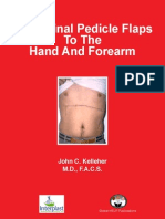 Abdominal Pedicle Flaps To The Hand and Forearm: John C. Kelleher M.D., F.A.C.S