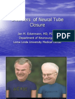 Disorders of Neural Tube Closure