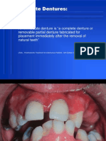 Immediate Denture
