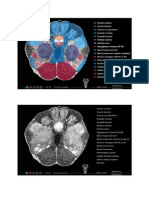 Caudal Midbrain Superior Colliculus