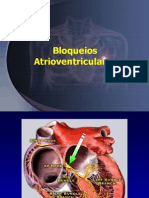 07+-+ECG+-+Bloqueios+atrioventriculares