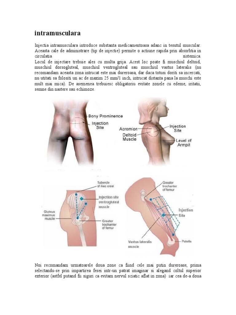 Intramuscular A | PDF