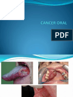 Cancer Oral