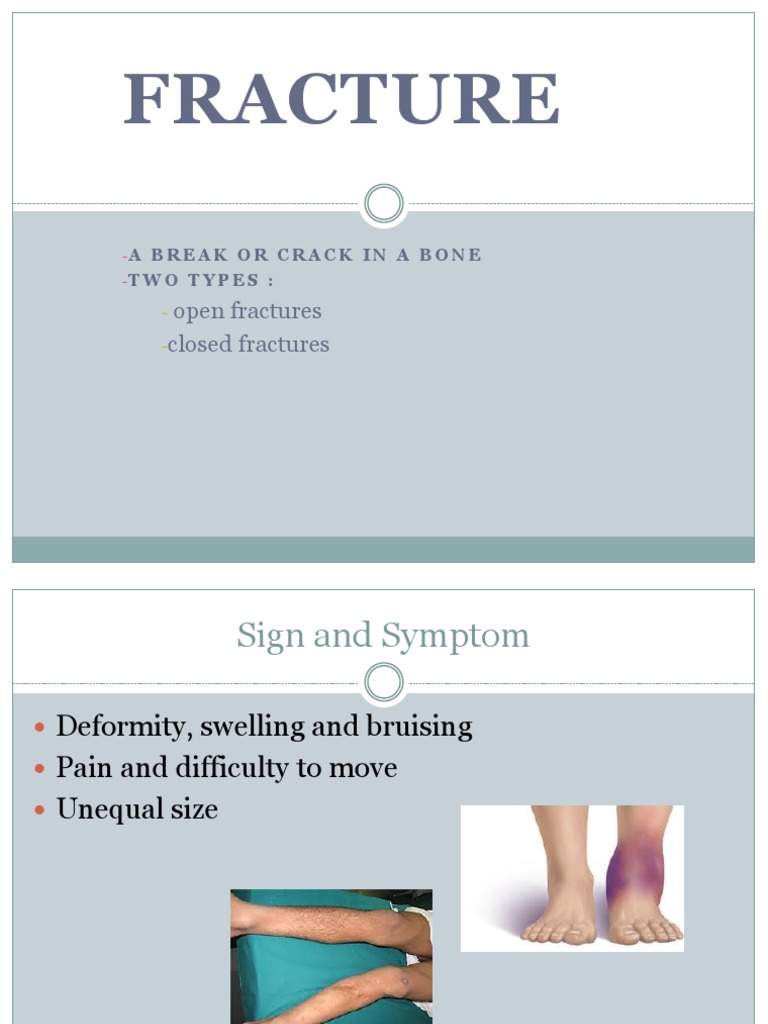 Fracture: Open Fractures Closed Fractures | PDF | Self-Improvement