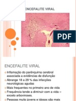 Encefalite Viral