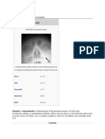 Sinusitis