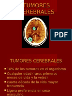 Tumores Cerebrales