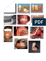 Tarea Medicina Tumores