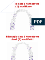 Clasele de Edentatie