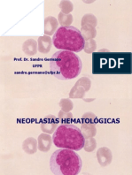 Neoplasias hematologias