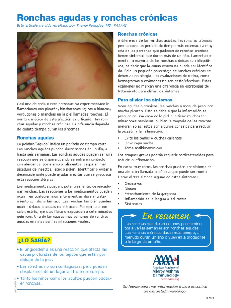 EL Hives Patent Spanish PDF Alergia Inmunología