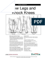 Bow Legs and Knock Knees: Patient Information