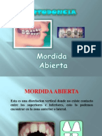 mordidaabierta-090420184010-phpapp01