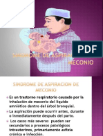 Sindrome de Aspiracion de Meconio