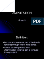 Amputation 
