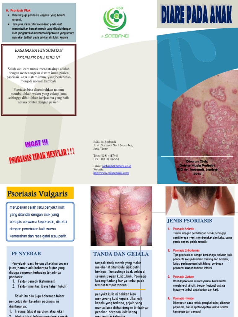 Pengertian dan Jenis Psoriasis Plak | PDF | Kesehatan Holistik