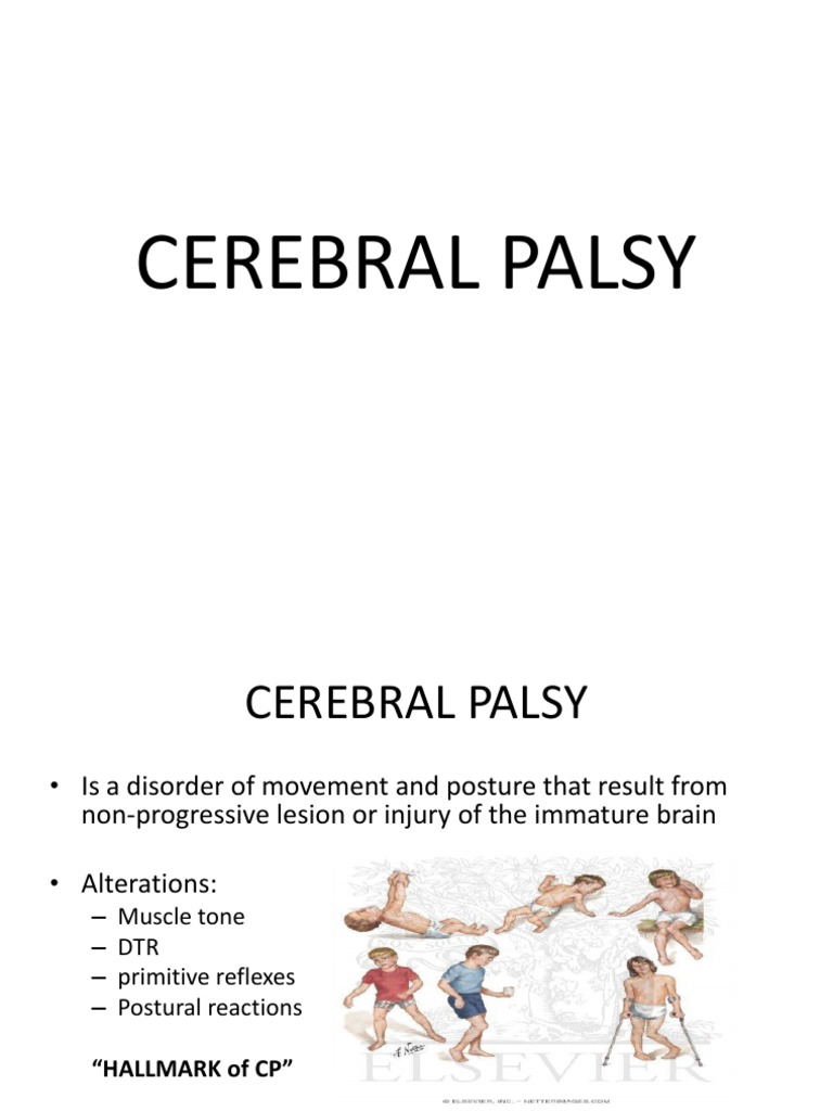 Medback Cerebral Palsy Medical Specialties Clinical Medicine