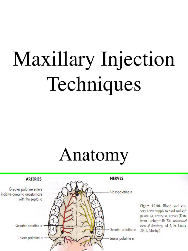 Maxillary Injection Techniques PDF Anesthesia Injection (Medicine)