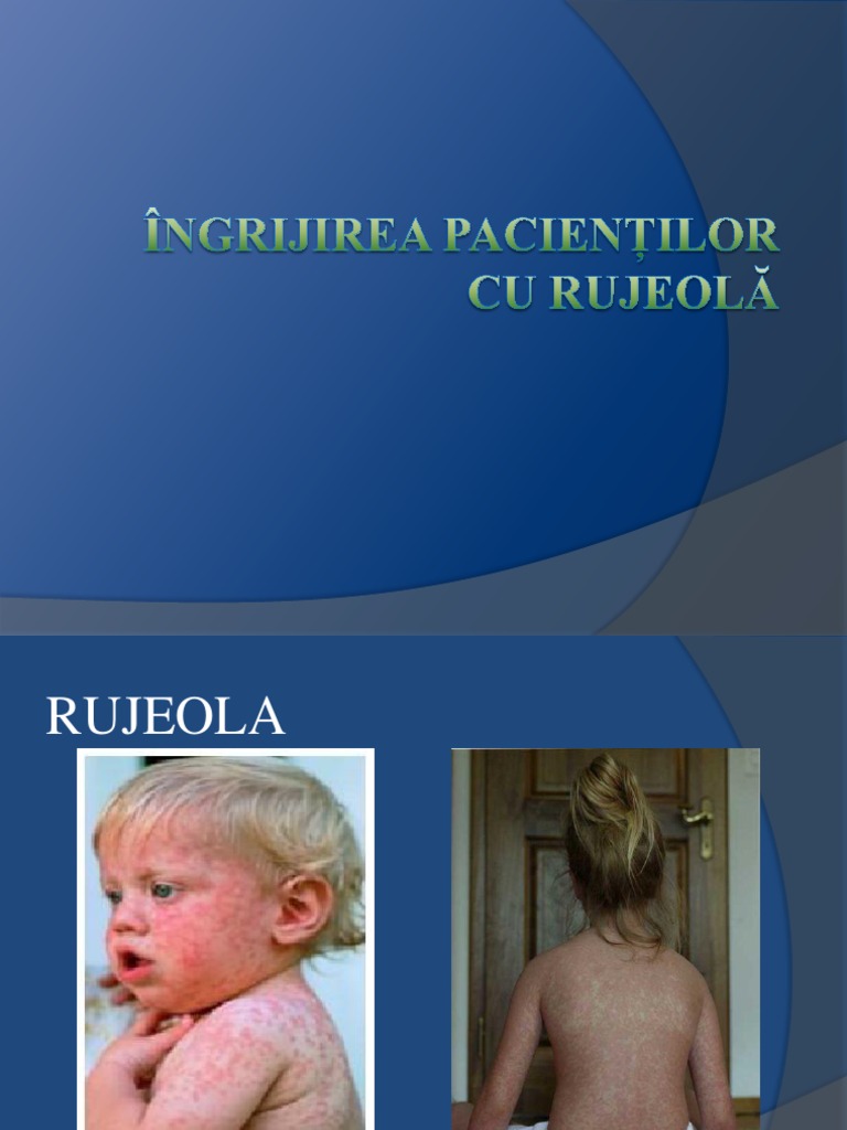 Rujeola | PDF