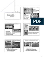 2 Pontics and The Edentulous Ridge