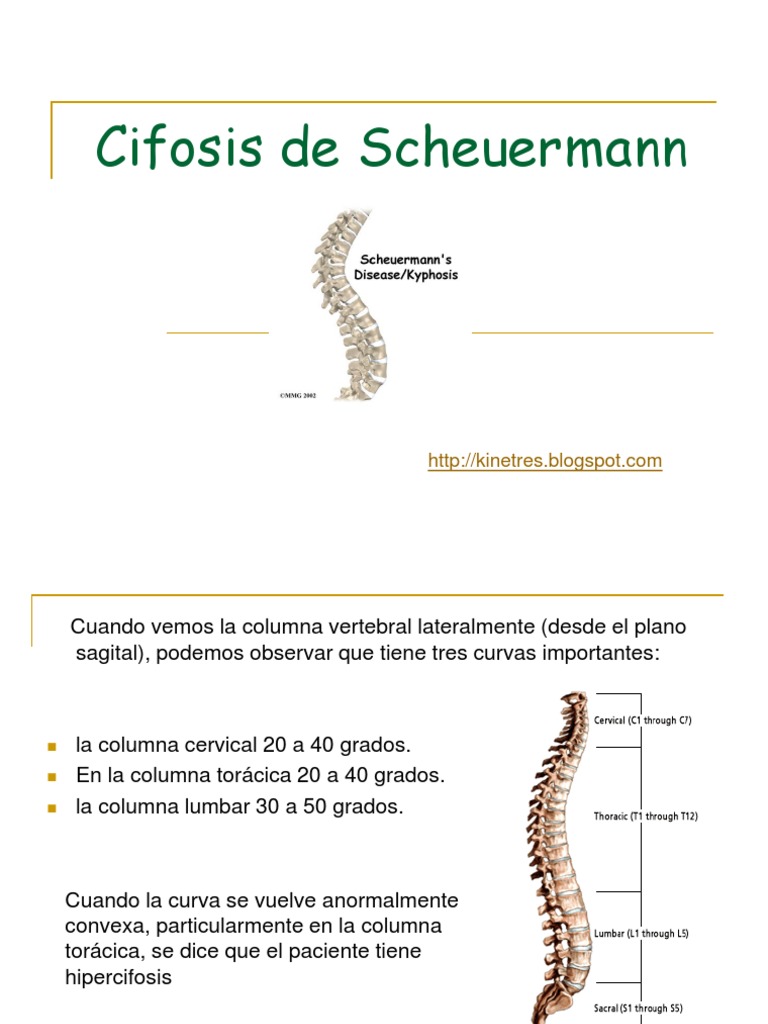 cifosis-de-scheuermann-la-columna-vertebral-anatom-a-humana