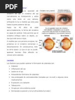 Informe cataratas