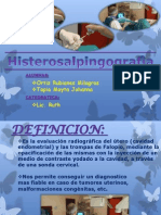 Histerosalpingografia Imagenes