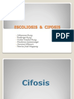 Cifosis y Escoliosis