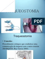 Traqueostomia: Procedimento Cirúrgico para Abertura na Traqueia
