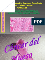 Cancer Del Hueso