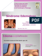 sindrome edematoso
