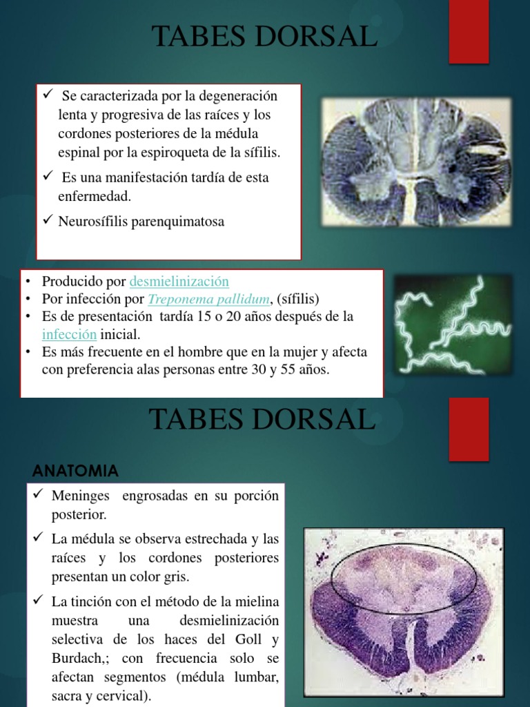 Tabes Dorsal 1 PDF