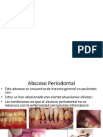 Absceso Periodontal