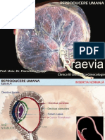 Placenta Praevia