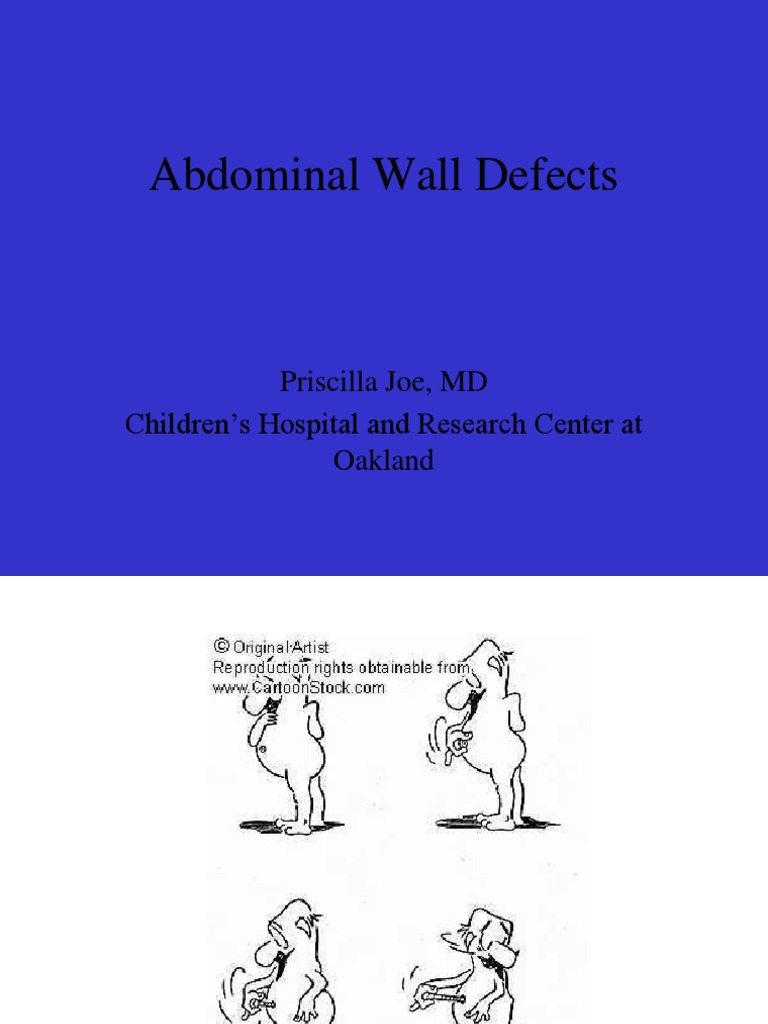 Abdominal Wall Defects: Omphalocele & Gastroschisis | PDF | Congenital ...
