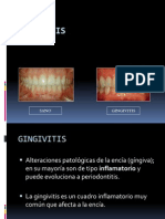 12gingivitis-1220658117779693-8