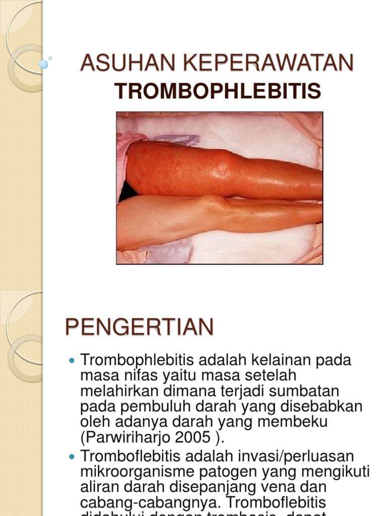 Asuhan Keperawatan Thrombophlebitis Pdf