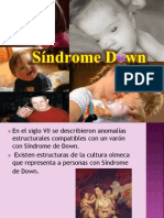 Sindrome de Down