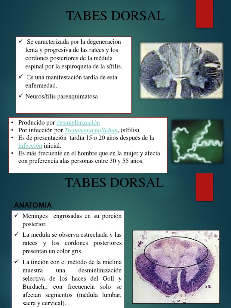 Tabes Dorsal 2