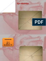 Eje Electrico y Electrocardioagrama Defi