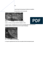 Sonografi Dari Orkitis Tuberkulosis